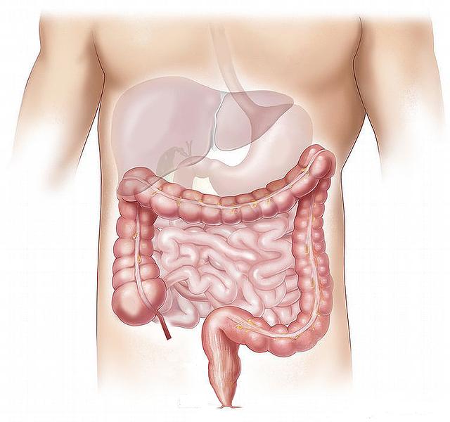 Common Signs of an Unhealthy Colon