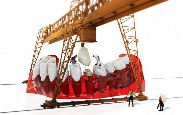 Dental Implant Care: How to Clean All on 4 Dental Implants for Longevity 2 Dental Implant Care: Understanding All on 4 Dental Implants for Longevity